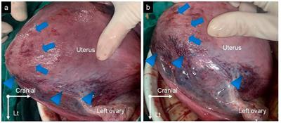 Case report: A relatively rare adverse event caused by carbetocin— placenta interception